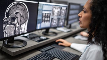 Substance use: Weed: Brain scan: doctor examining brain scan 1315172179.jpg