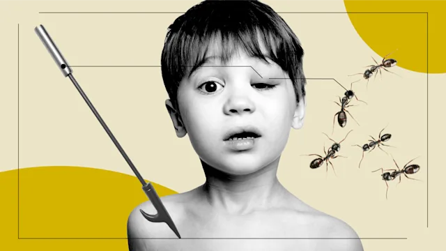 Health: Allergies: patient stories feel bee sting option 2