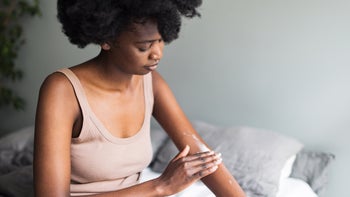 Dermatology: woman applying cream on arm 1558941236