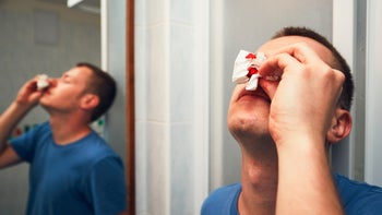 Health: Covid-19: man nosebleed tissue 696227572