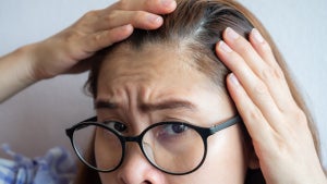 image from article, A Guide to Hair Loss in Women: Causes and Treatment for Thinning Hair