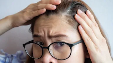 Close-up of a woman looking at a balding spot on her head. She had her brow furled in frustration and has round black glasses on.https://app.contentful.com/spaces/4f3rgqwzdznj/environments/master/assets
Boyloso/iStock via Getty Images