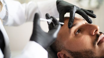 Facial wrinkles: man filler injection 1132333568