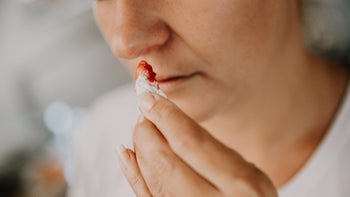 Health: Hemorrhage: GettyImages-1297415551