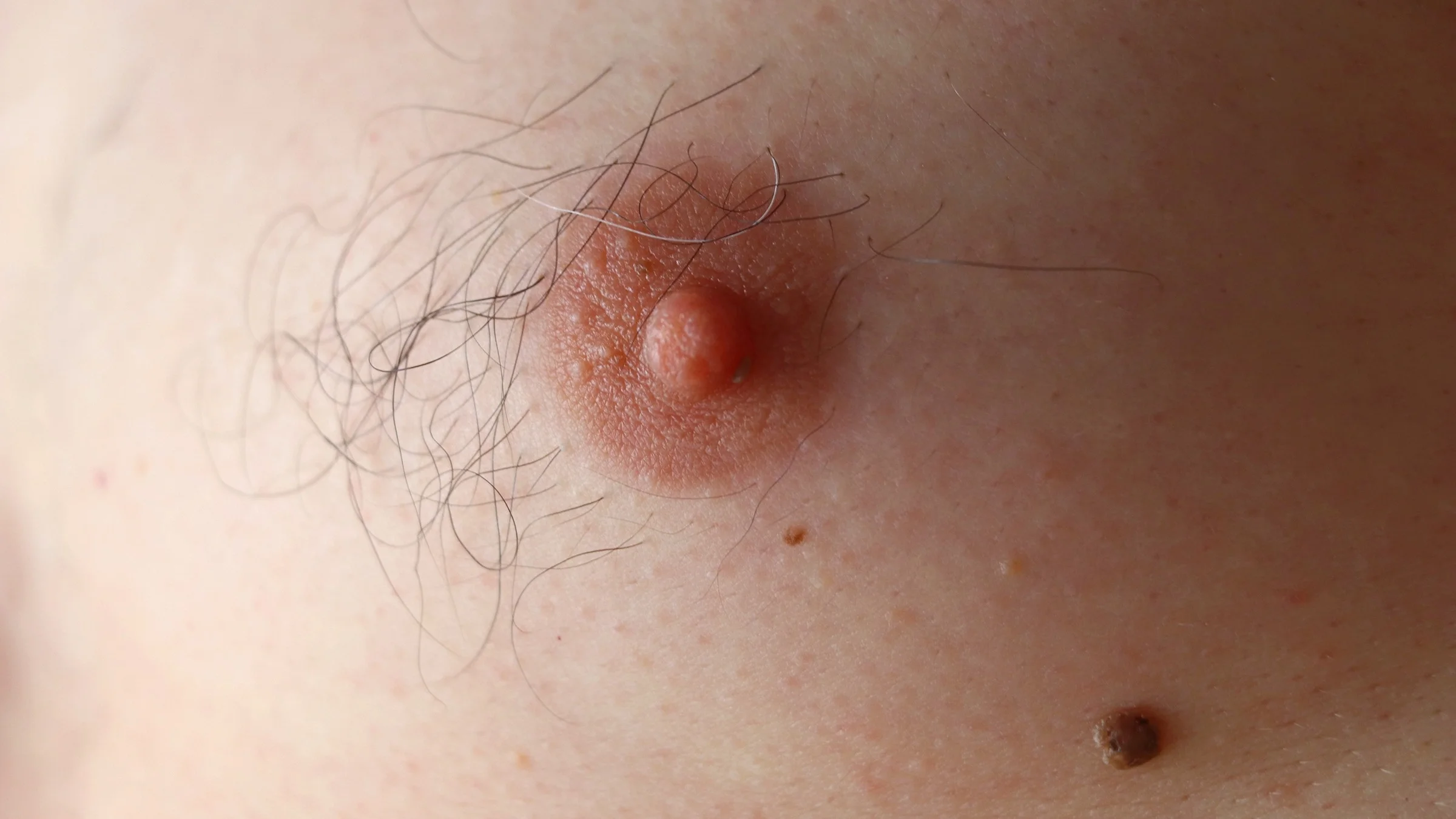 Close-up of a man's nipple with a mole underneath. He has dark black hair as well.