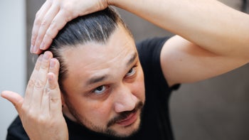 Hair loss: man checking hairline in mirror 2138687486