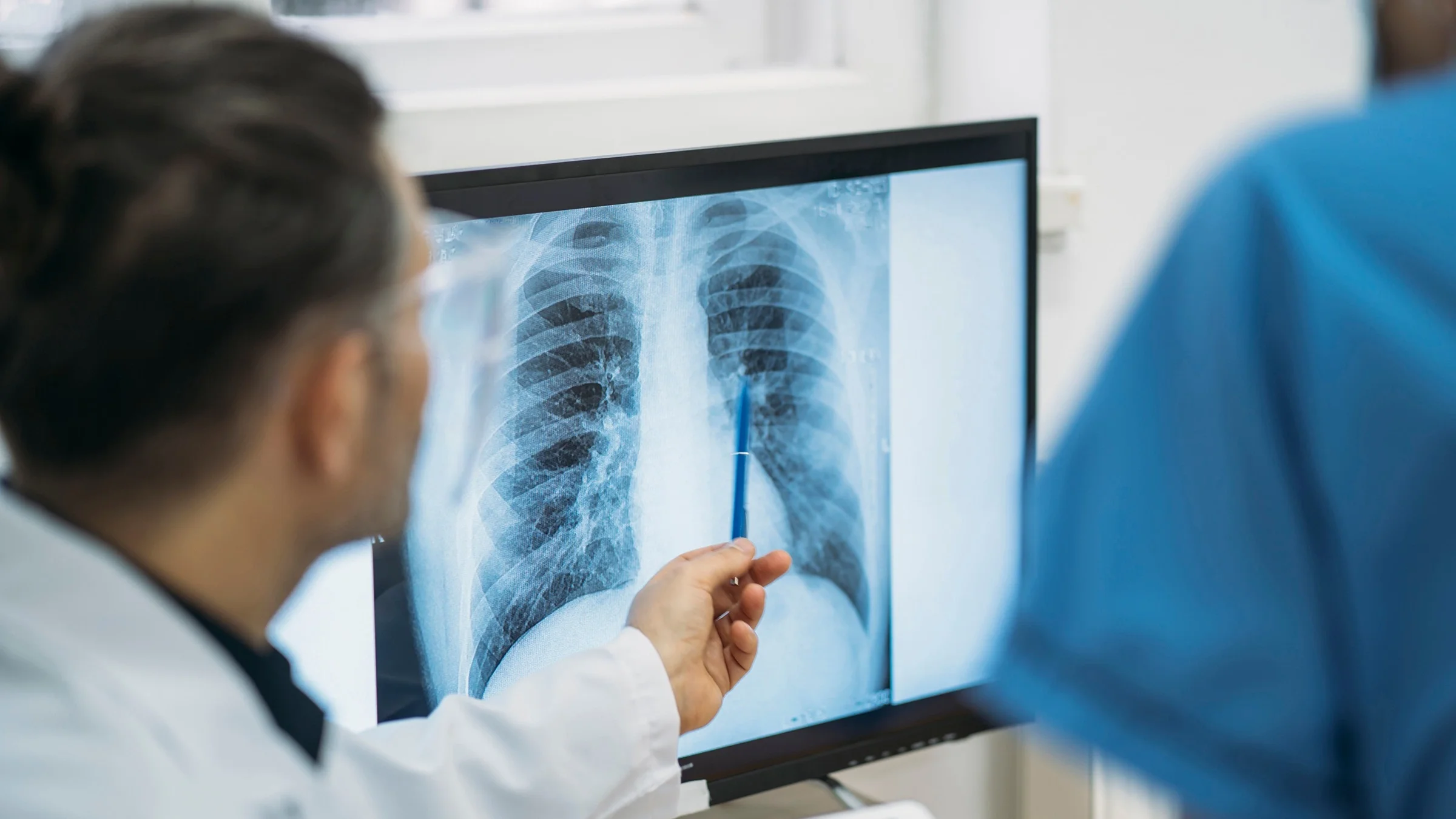 Cropped close-up of a doctor explaining a chest x-ray to a patient.