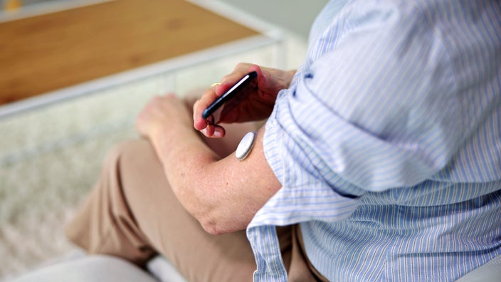 A person checks their blood sugar on their smart phone by using a continuous glucose monitor.