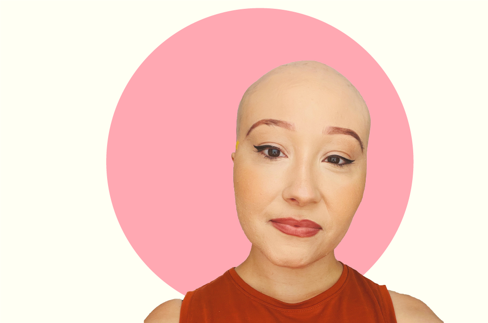 Selfie of Sarah Ribeiro, who is bald because of her alopecia condition.