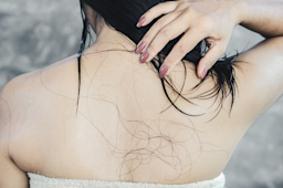 Women are 10 times more likely to have symptoms of hypothyroidism than men. Here are the signs and symptoms to look out for.