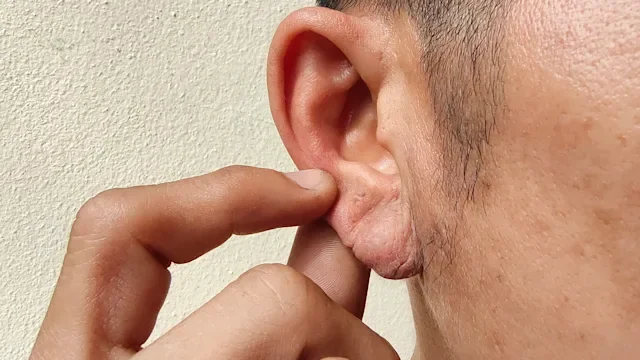 cardiovascular: closeup crease on ear lobe 1478907172