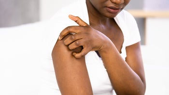 nemluvio: closeup woman scratching arm 1435081526