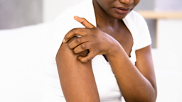 A woman scratches her arm.
AndreyPopoviStock via Getty Images Plus 