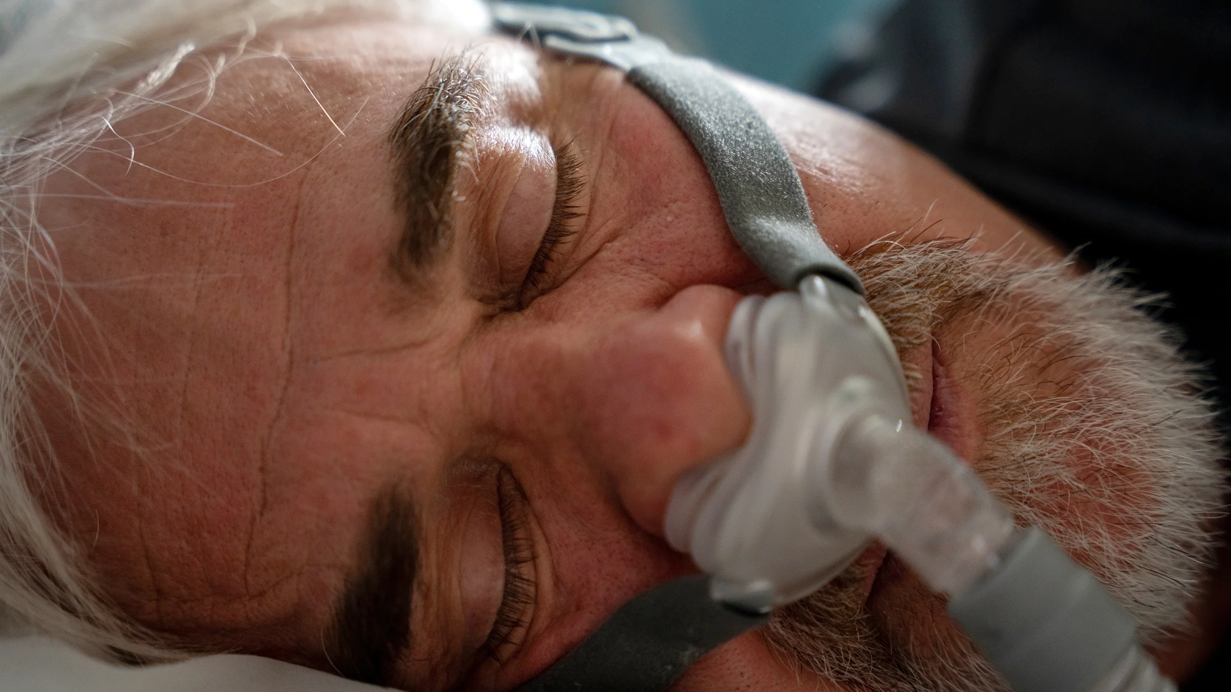 A man with sleep apnea is using a CPAP machine while sleeping.