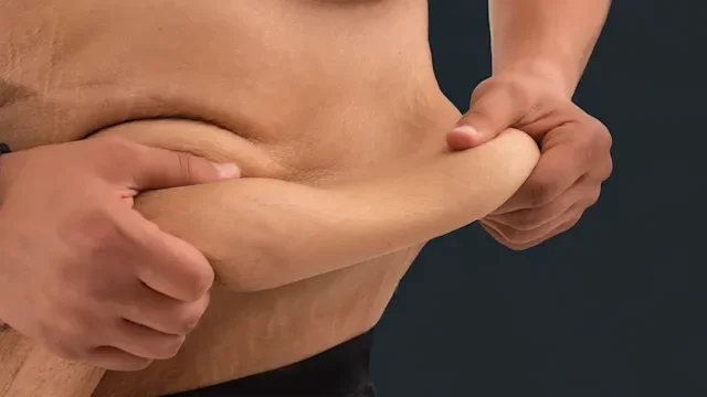 Weight-loss: closeup man with loose skin