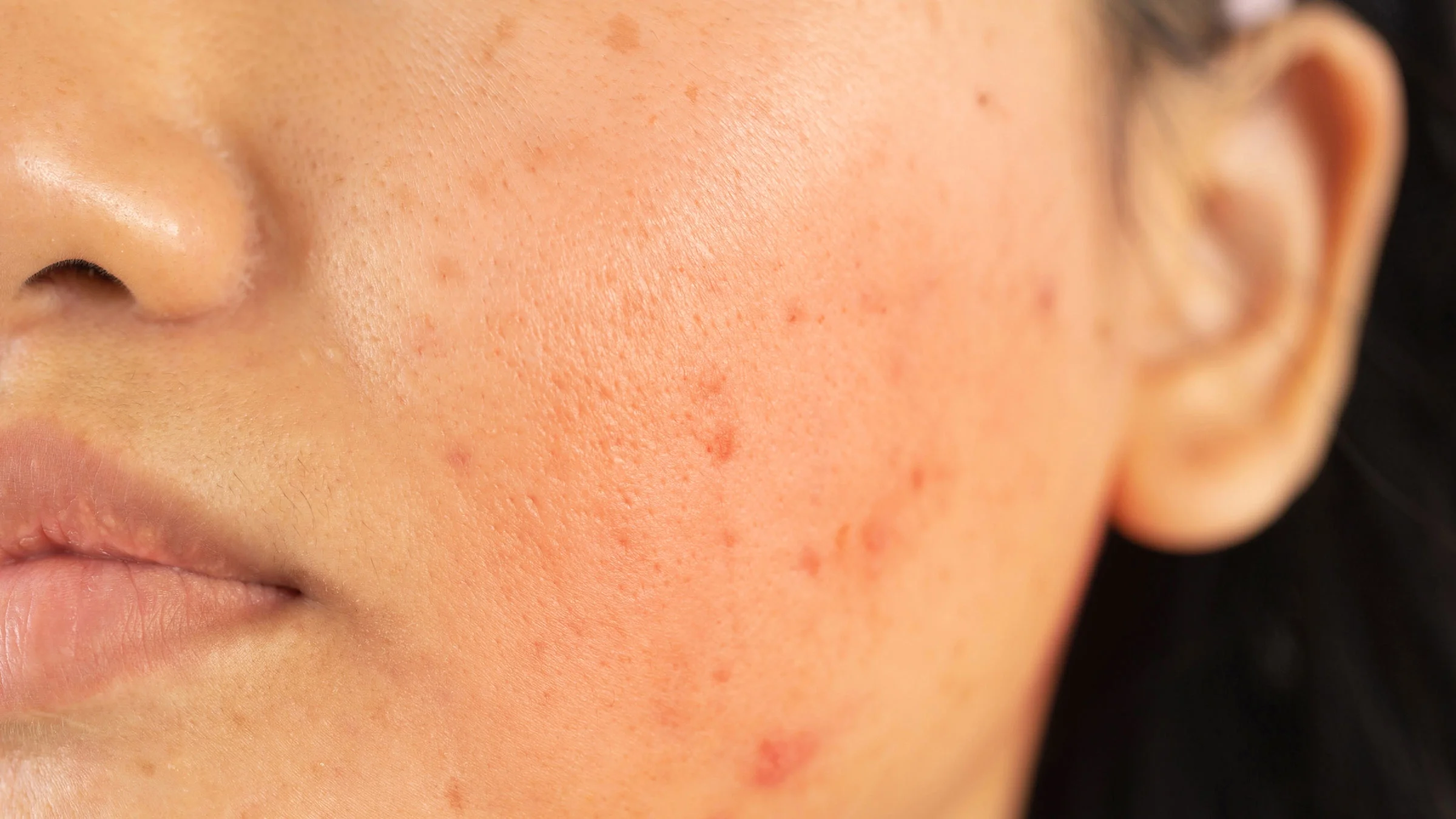 Close-up of a flushed face.