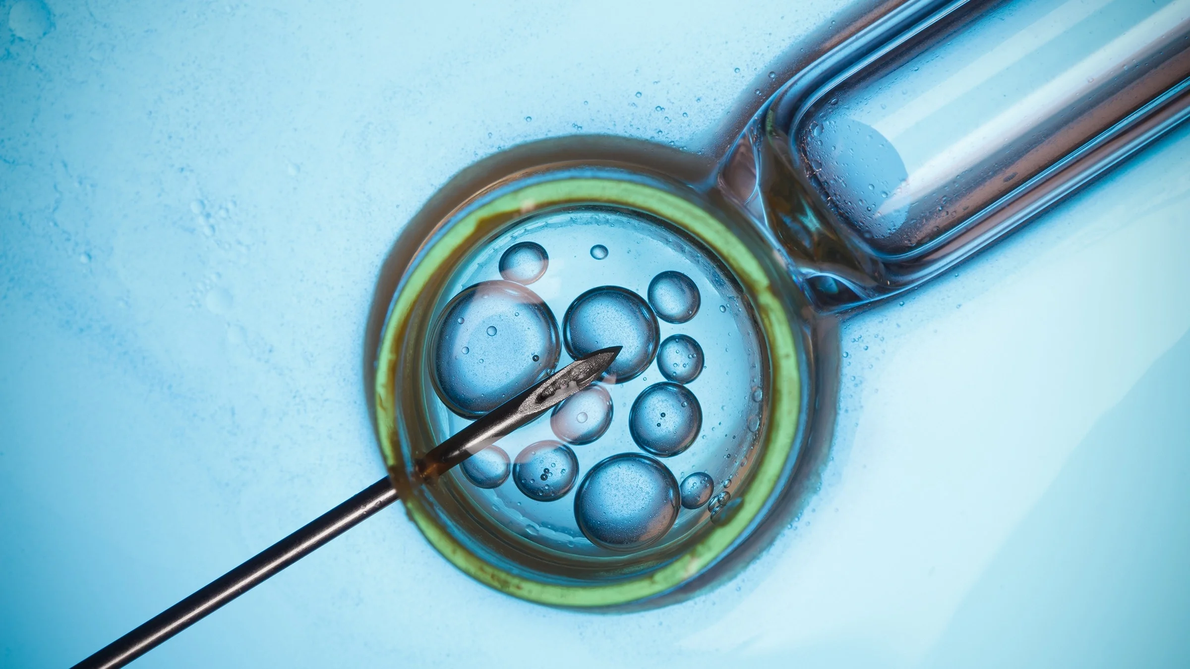Microscopic image of in vitro fertilization (IVF). The background is a light blue color and there is a green looking edge to the egg under the microscope.