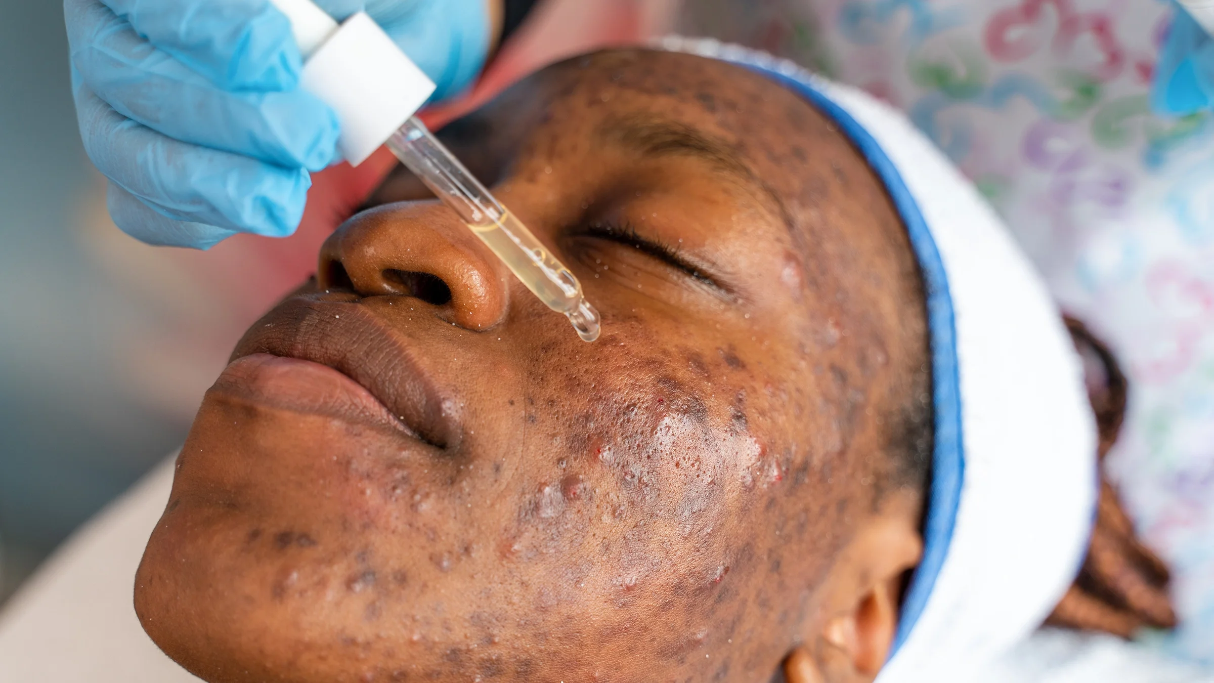 A person gets serum applied to their face.