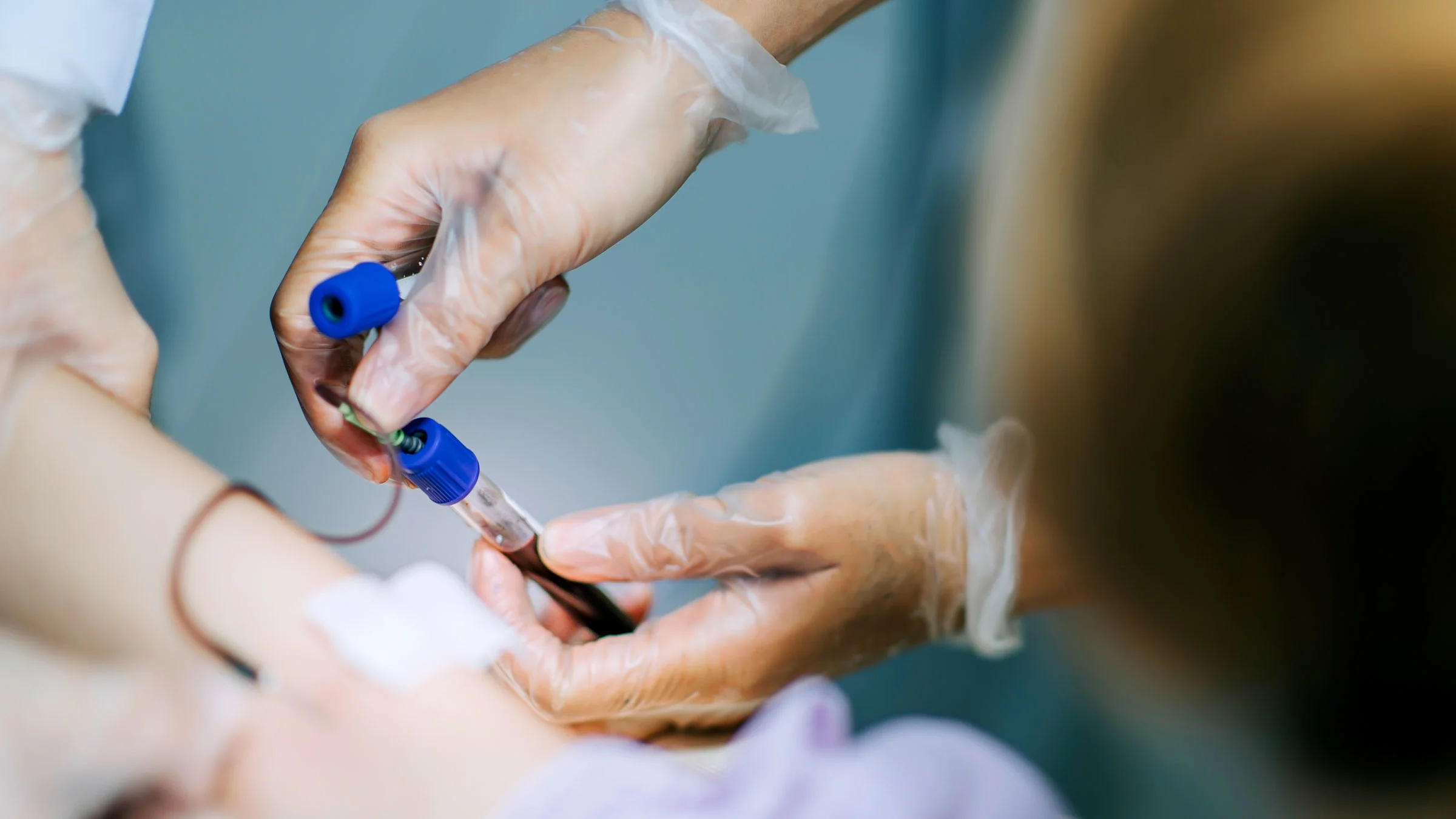 Close-up drawing blood from patient arm's vein.