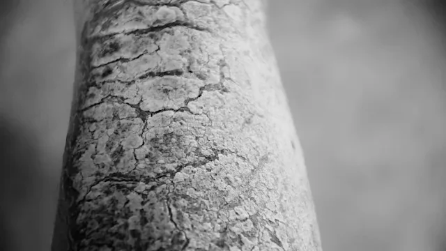 Psoriatic Arthritis Rash: Pictures, Symptoms, and Treatment Options
