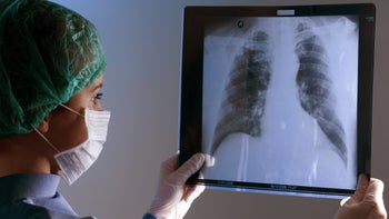 Research: Pulm dessert: pulmonary xray doctor-108267784