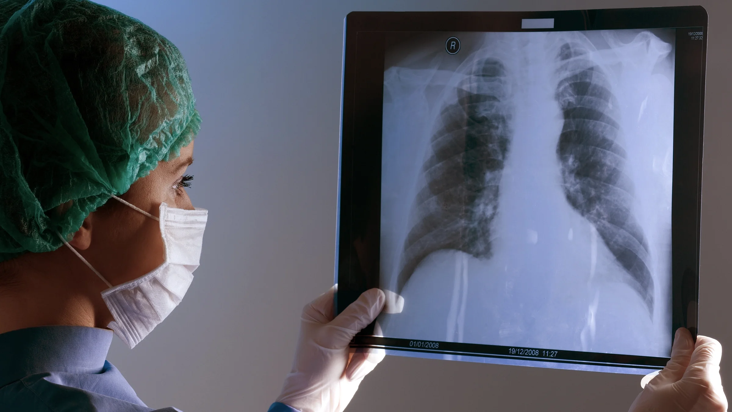 Pulmonologist reviewing a chest x-ray.