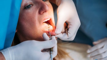 Dental-care: woman at dental check up 1396458914