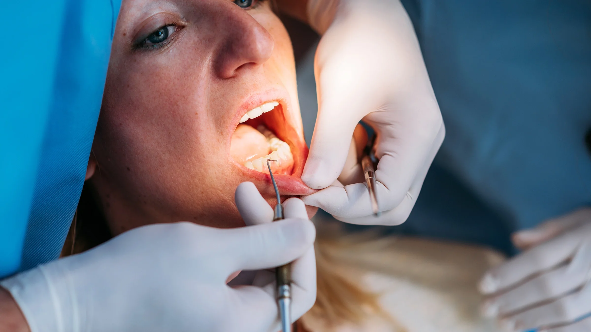 Close-up woman at dental check up.