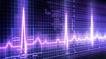 Heart: 3d electrocardiogram 157375351