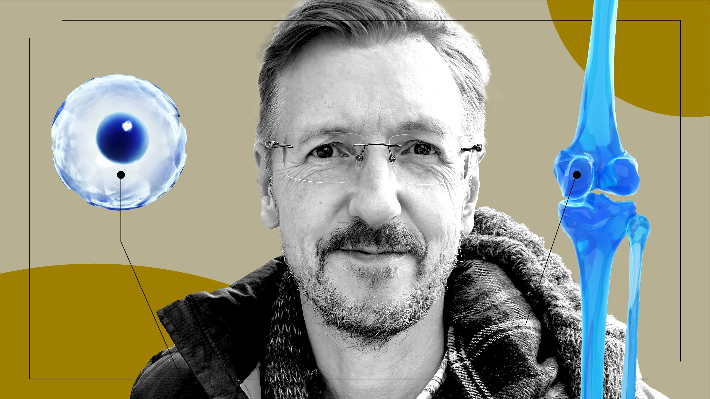 A graphic includes a black-and-white photo of a man with 3D illustrations of a stem cell and leg bone. 