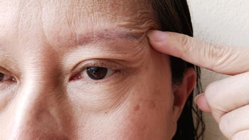 neurological: closeup raised eyebrow 1620660706