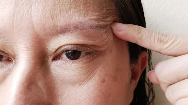 neurological: closeup raised eyebrow 1620660706