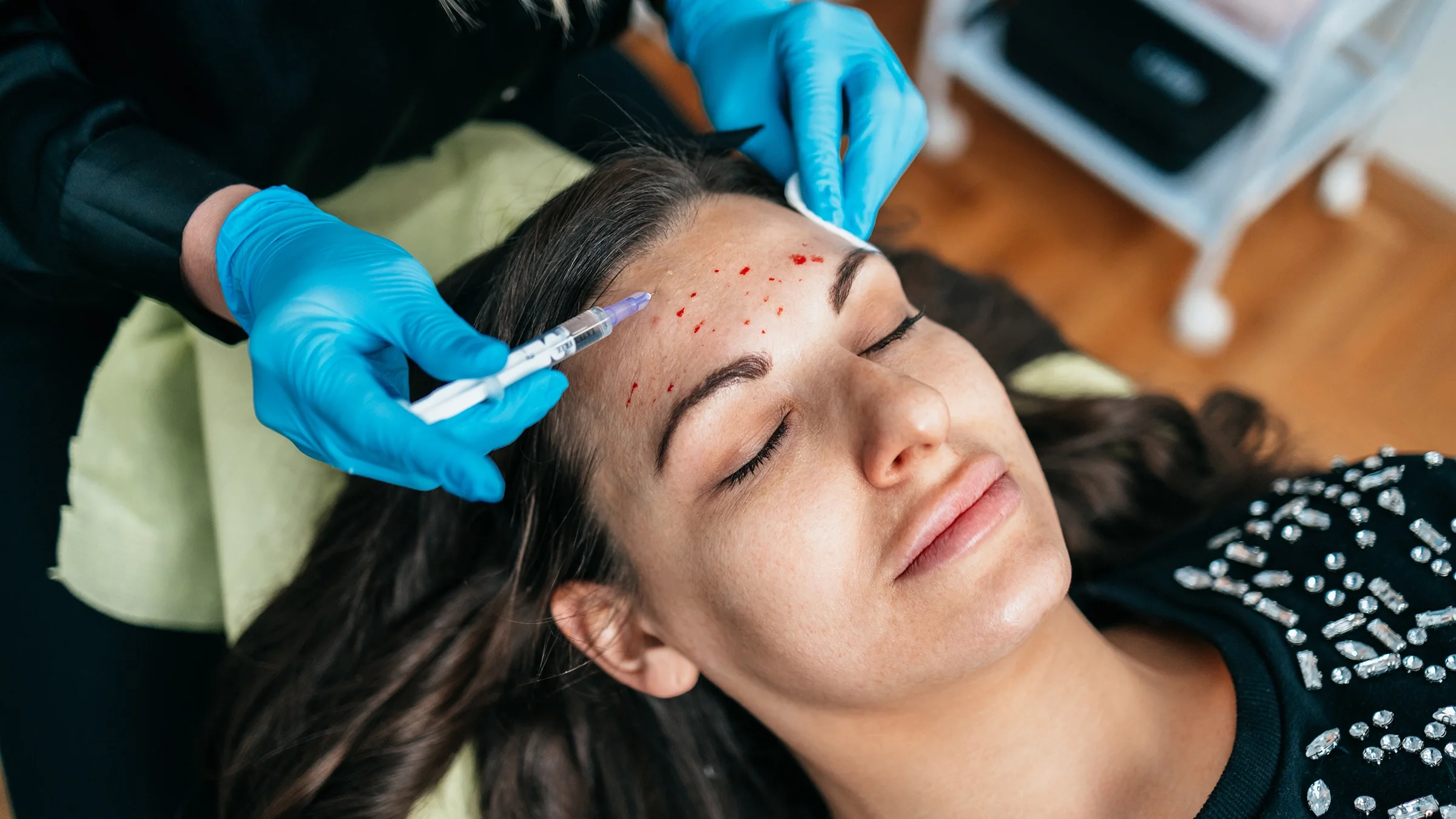 Woman receiving vampire facial.