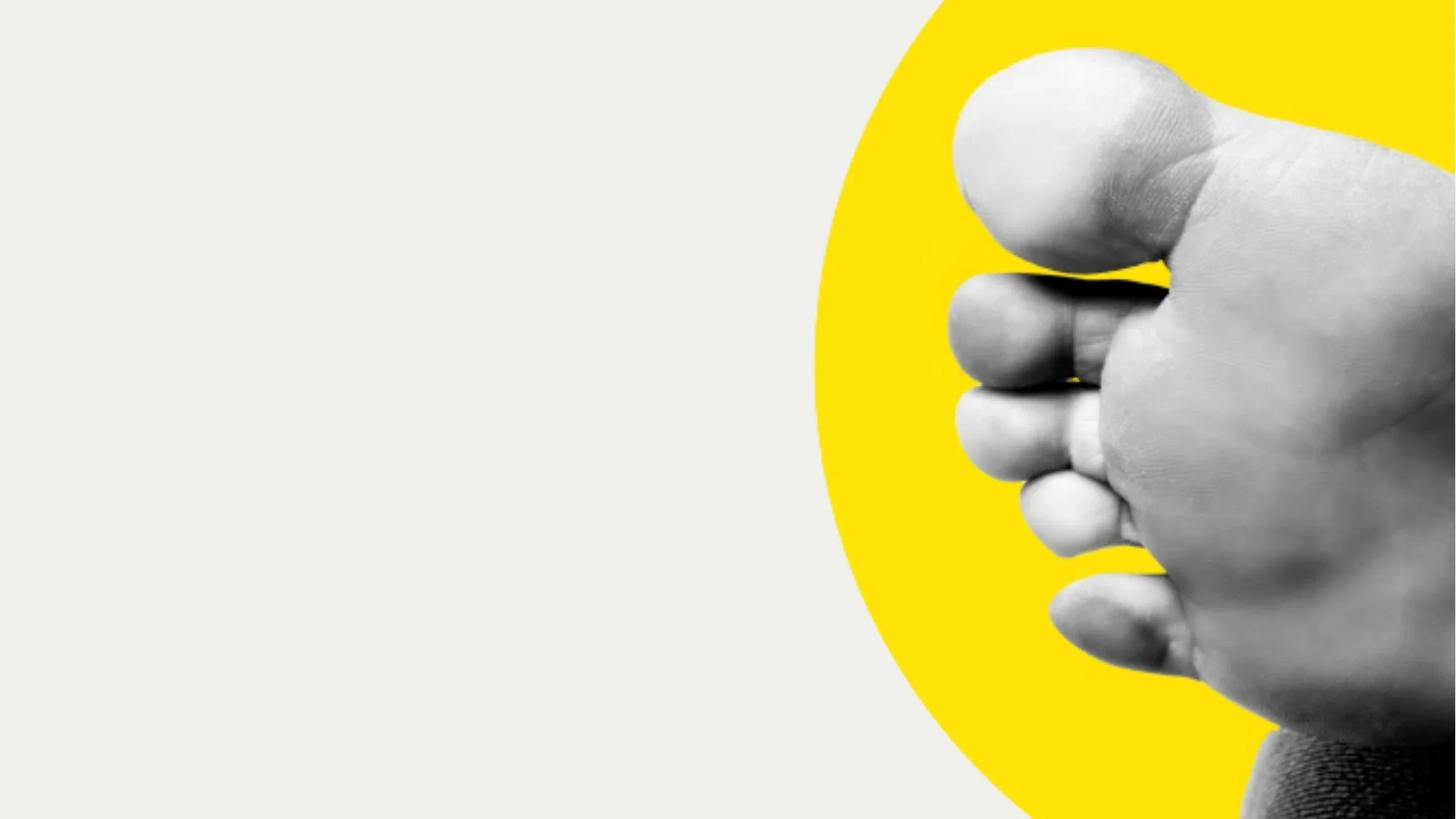 Black and white close-up of a person's foot with Raynaud's syndrome, where there is a lack of blood flow and the foot turns white. There is an added yellow graphic half circle belhind the foot.
Petra Richli/iStock via Getty Images