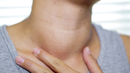 Cropped close-up shot of a woman's enlarged thyroid.
Credit: sasirin pamai/iStock via Getty Images
