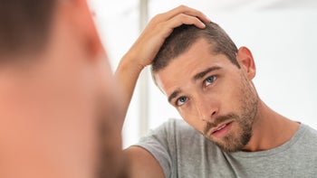man looking in mirror bald patch 1158244386