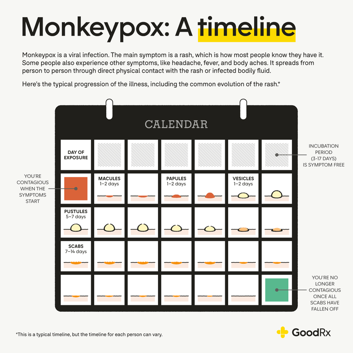 Monkeypox: How it spreads, who's at risk - here's what you need to know