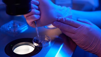 Reproductive health: closeup injecting eggs onto petri plate 1732050393