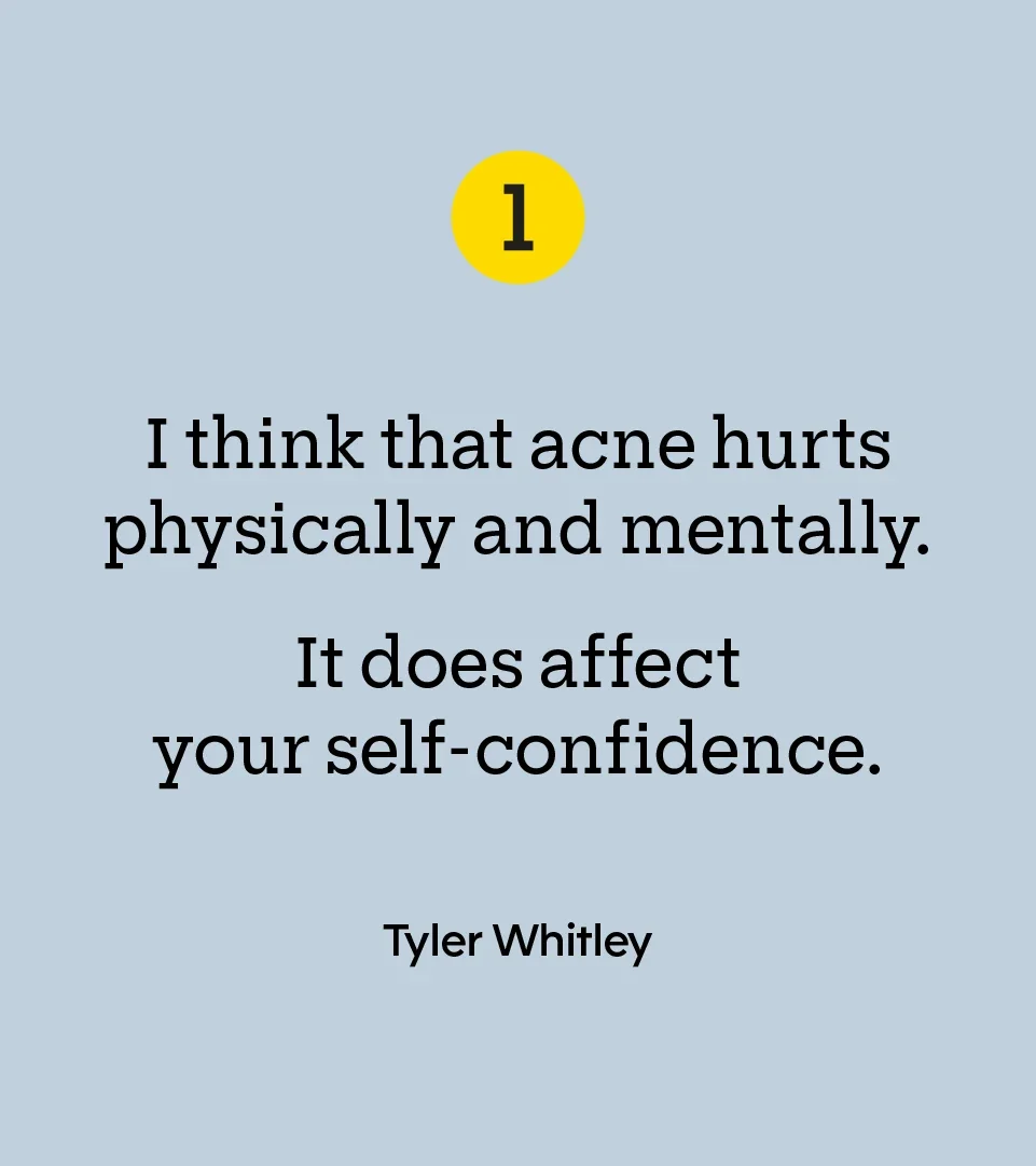 “I think that acne hurts physically and mentally. It does affect your self-confidence.” — Tyler Whitley