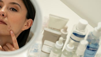 Retinoids: Acne: examining acne in mirror skin products on counter 1280053061