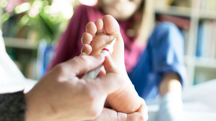how to get rid of warts on child's foot