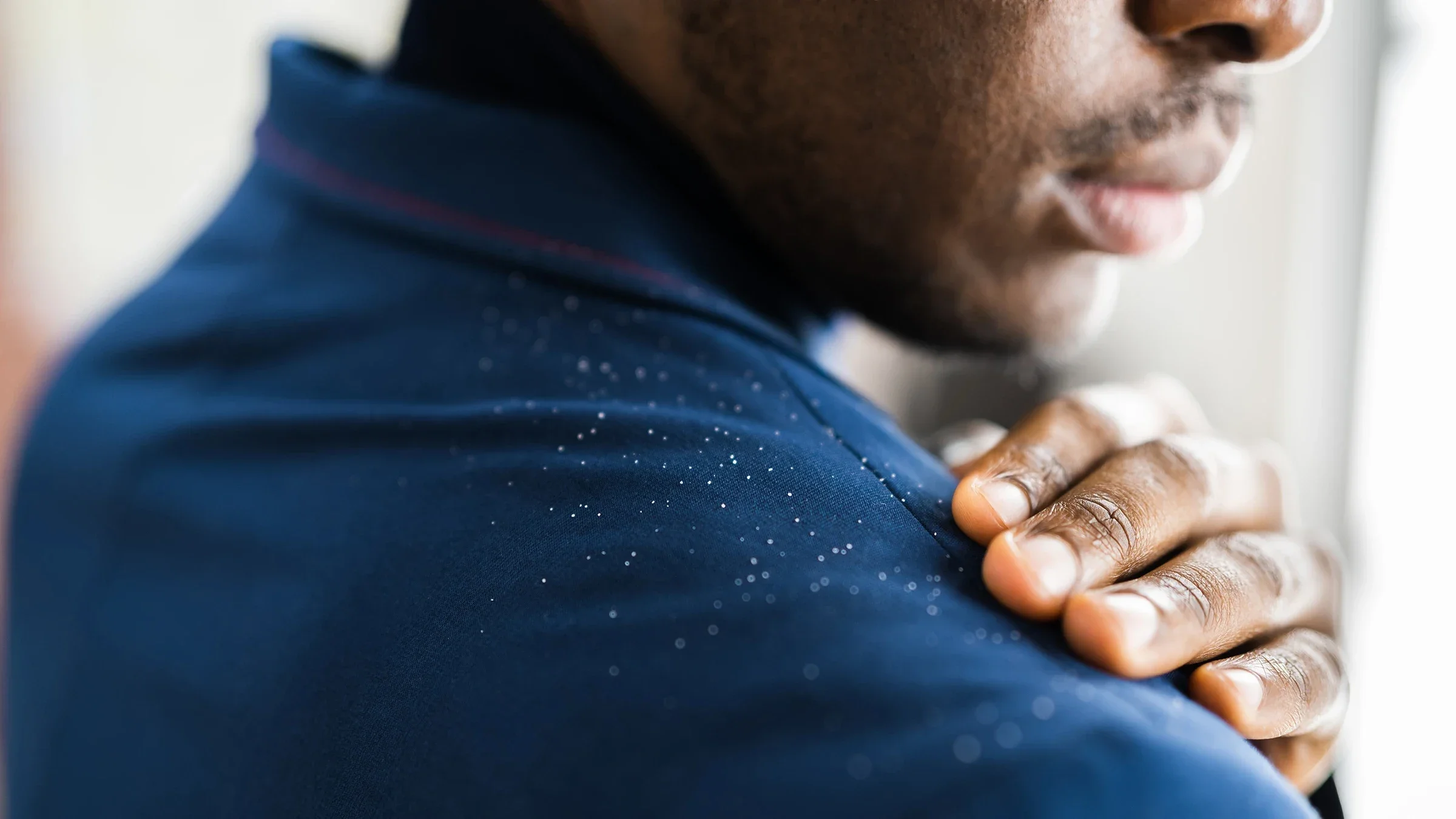 A man brushes dandruff off his jacket. There are many things that cause dandruff, from fungus and scalp irritation to changes in humidity level.
AndreyPopov/iStock via Getty Images Plus