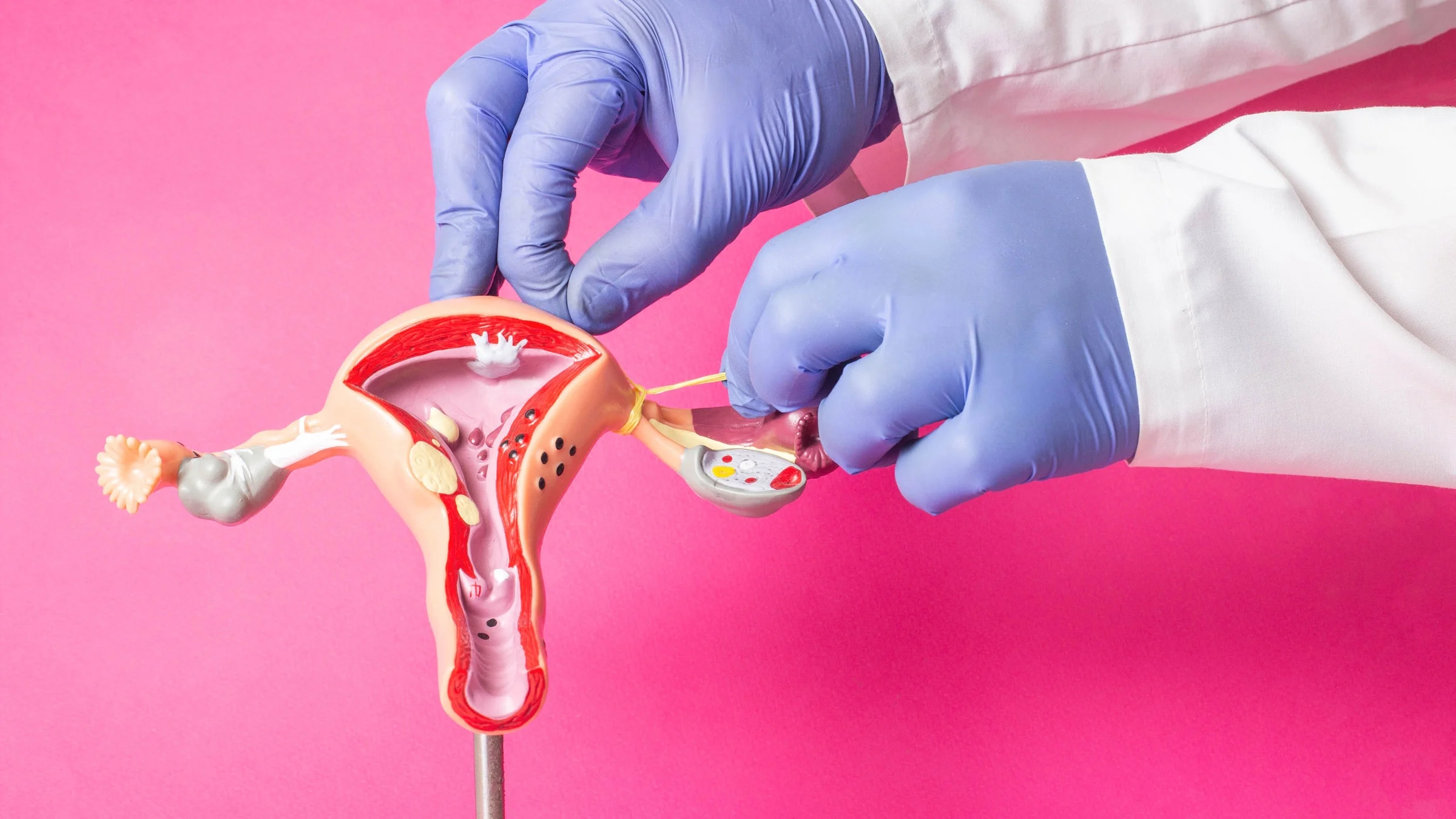 Close-up doctor ligates fallopian tubes on female reproductive model