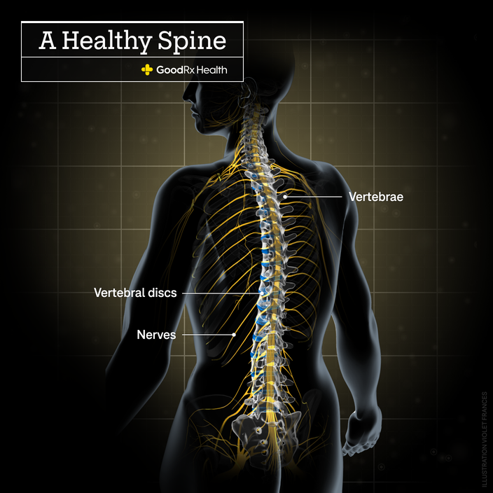 A 3D illustration of a healthy spine including vertebrae, vertebral discs, and nerves.
