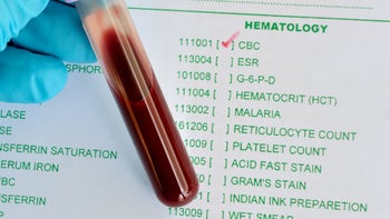 Diagnostics: blood test cbc 479562208
