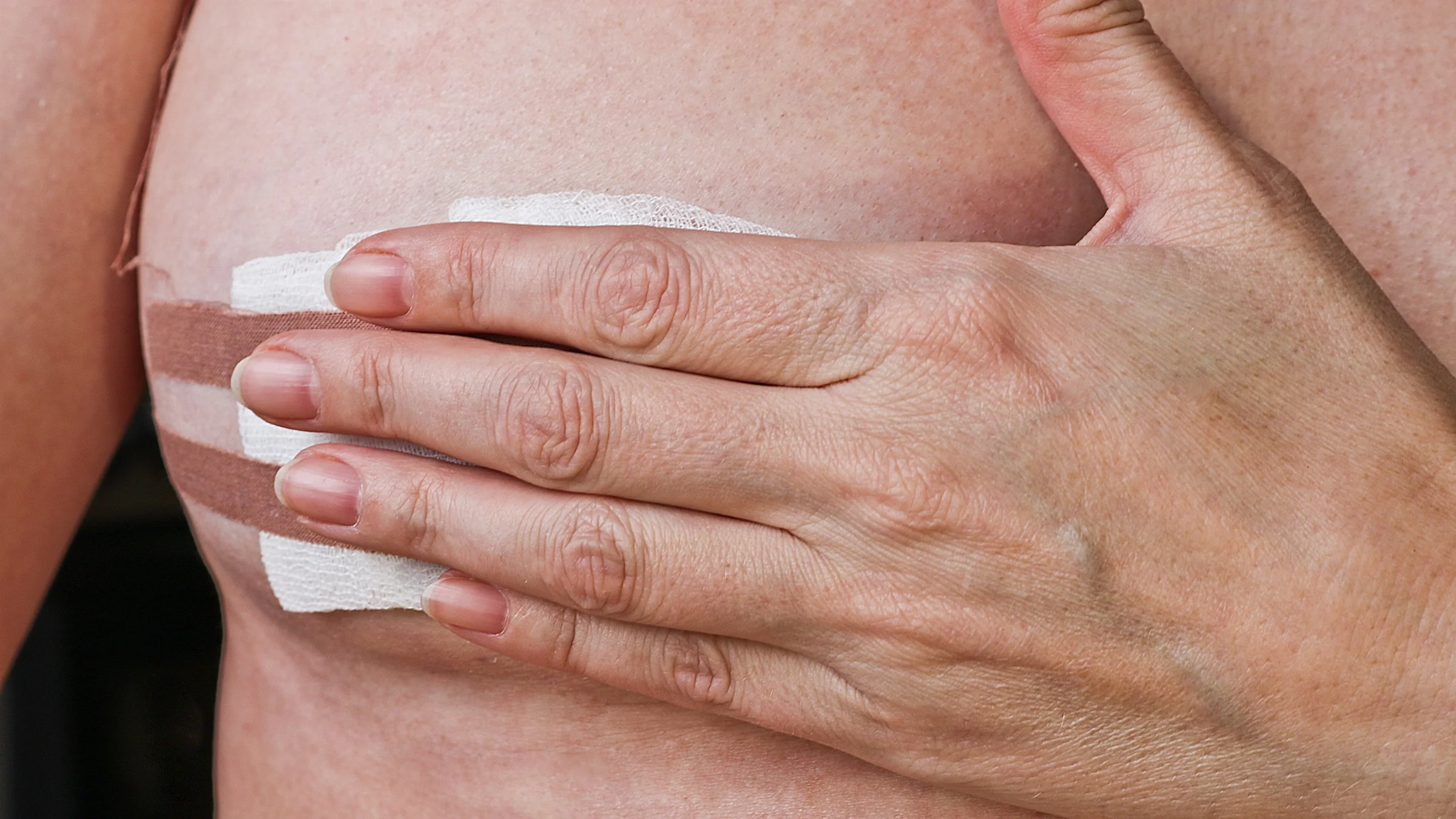 Close-up of a woman holding her hand over her breast. Her breast has gauze bandage over it.
