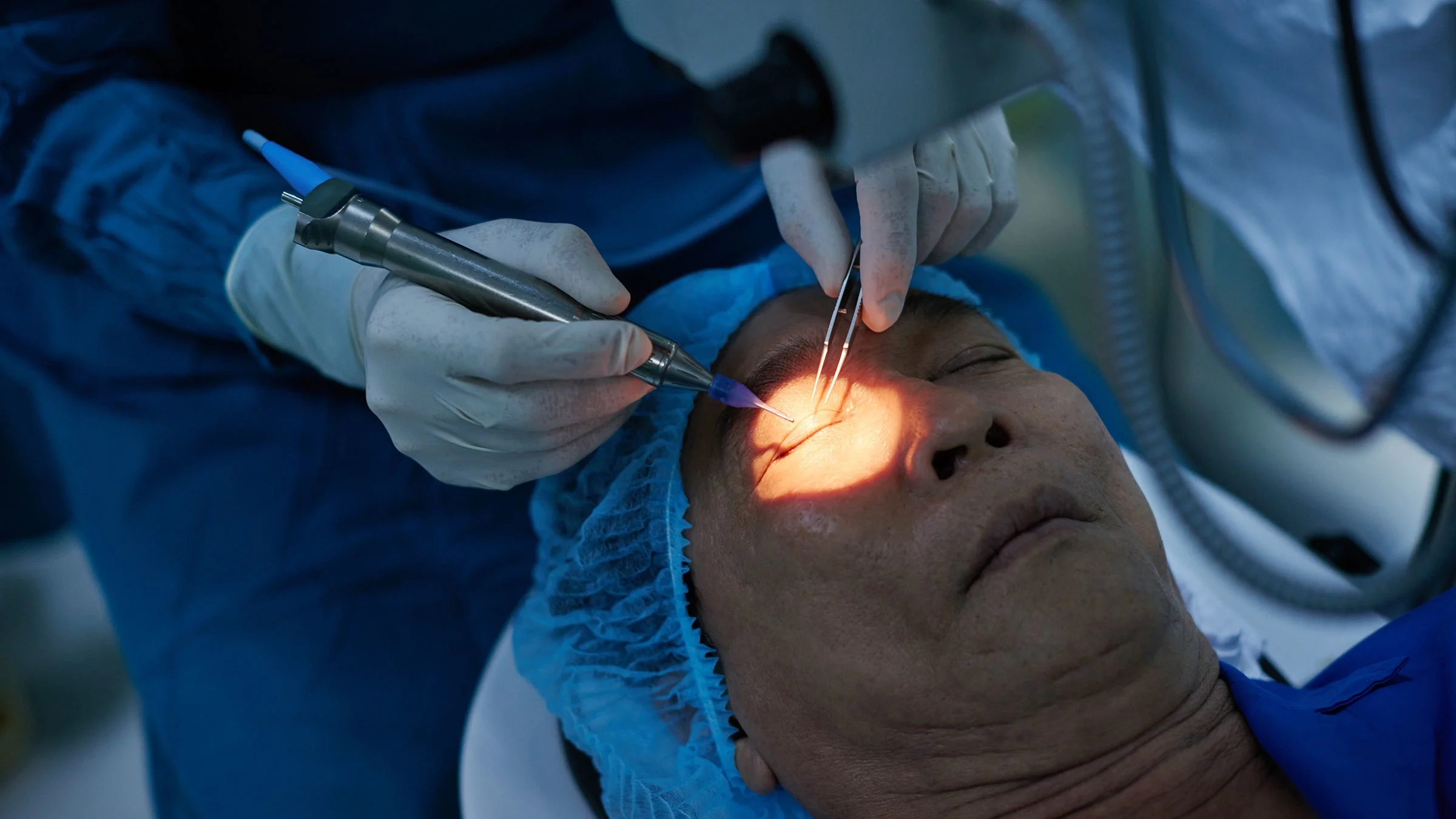 An ophthalmologist is ready to perform surgery. Glaucoma surgery can prevent the condition from progressing.