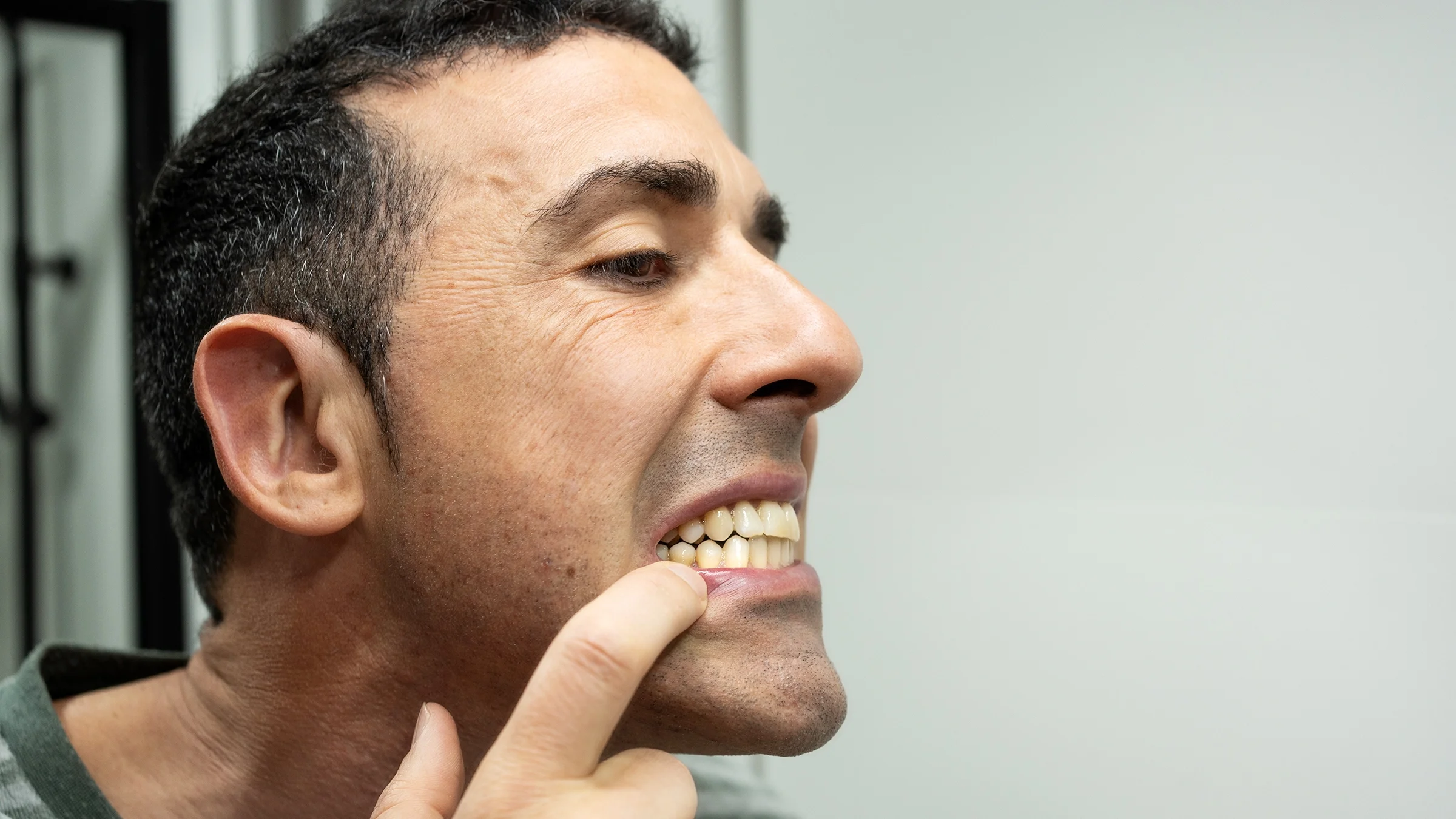 Man examining his teeth in the mirror.