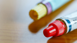 Two ointments tubes next to each other. 
Wako Megumi/iStock via Getty Images 