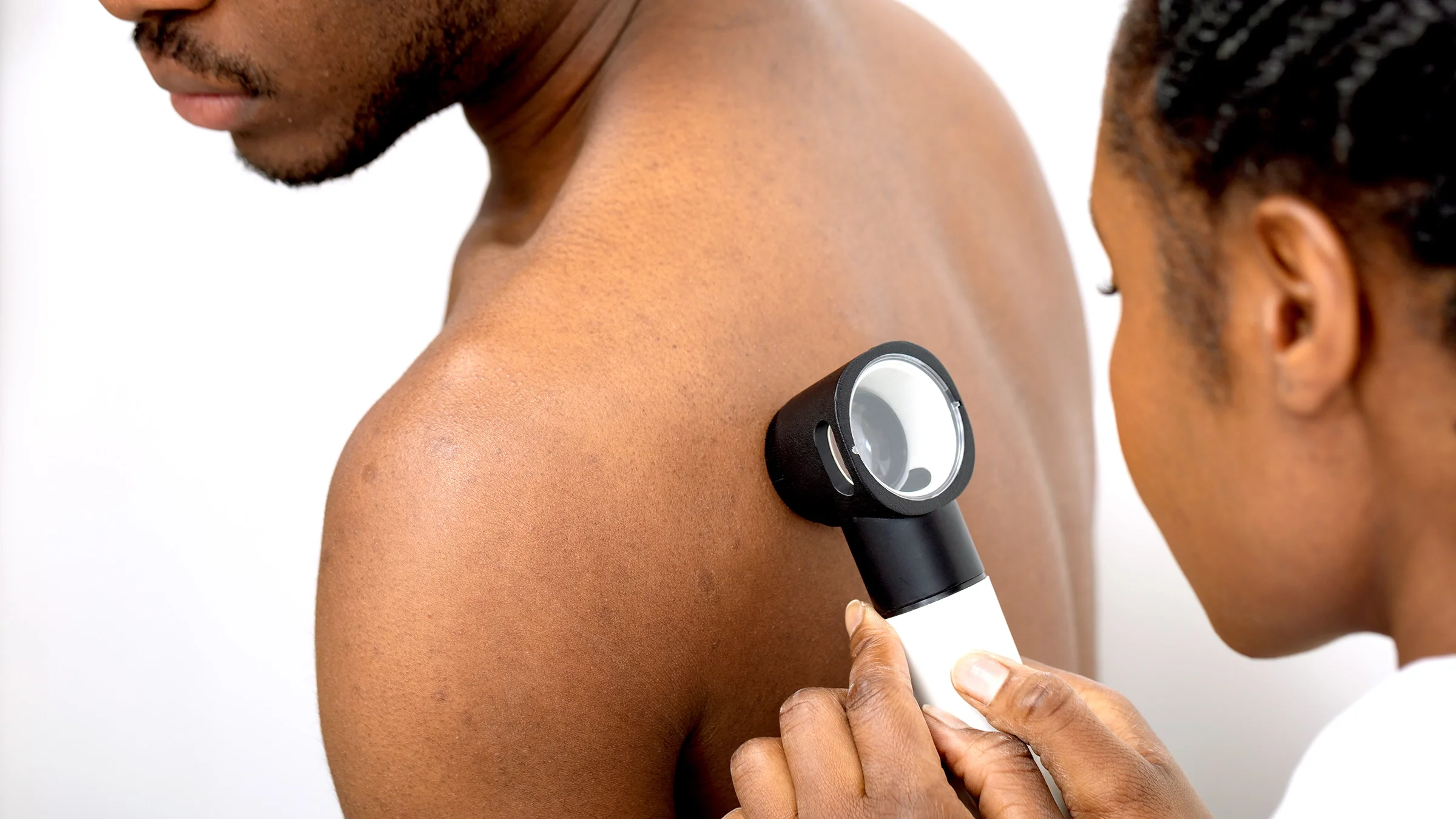 Close-up of a doctor examining a male patient's back for skin cancer.